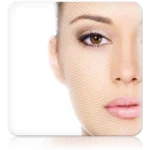 Dermabrasion