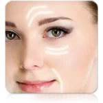 Radiofrequency