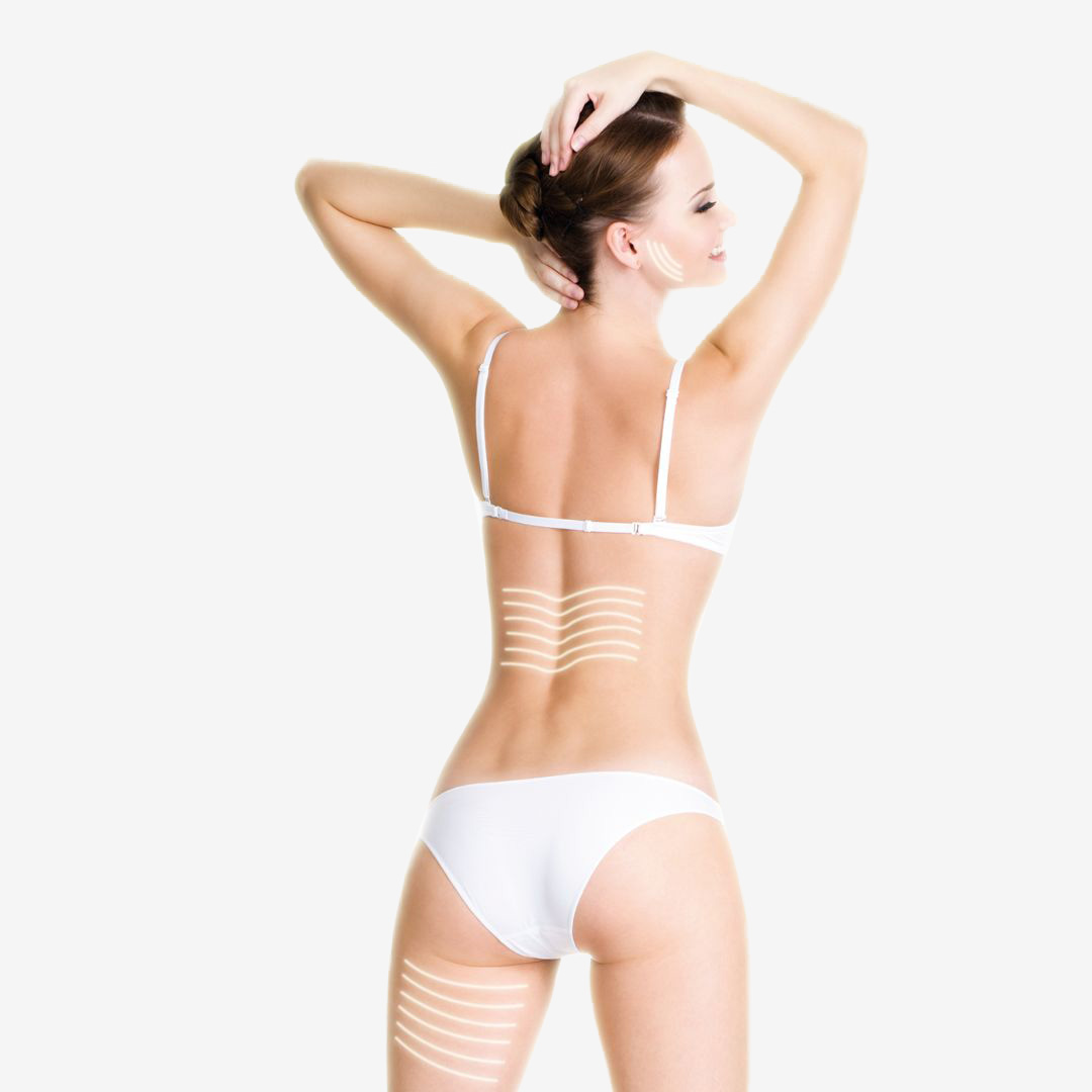Cellulite